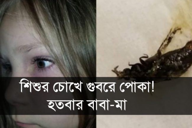 শিশুর চোখে গুবরে পোকা! হতবাক বাবা-মা