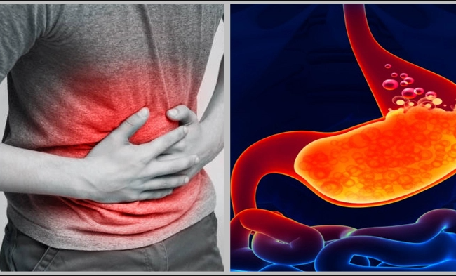 পেট ফাঁপা ও বদহজম থেকে মুক্তির আশ্চর্য্য উপায়!